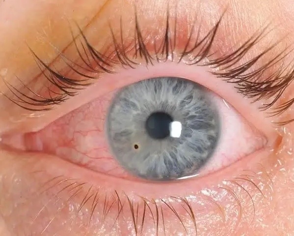    Фото: https://vk.com/semashkorzn