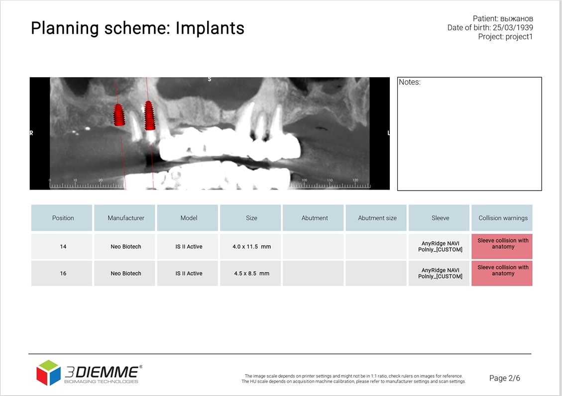 Планирование имплантации.Пациент 87 лет.Имплантация прошла успешно.