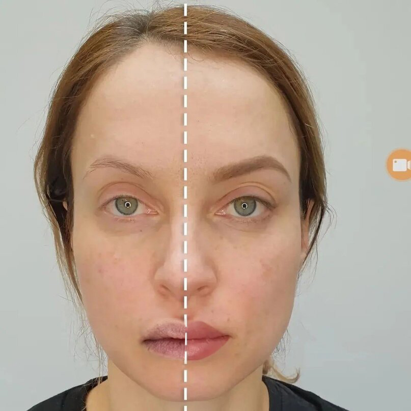 Примерка эскиза перманентного макияжа с использованием декоративной косметики.