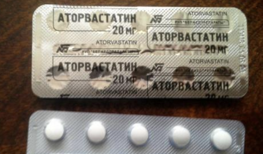 Боль в мышцах от статинов: защита сердца ценой дискомфорта?