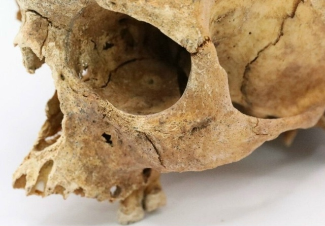 Череп жителя средневекового Укека.