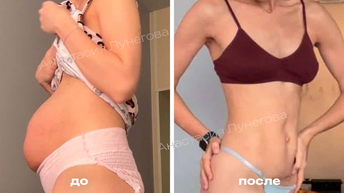 Фото «до» - через пару дней после кс. Фото «после» – через 9 месяцев.