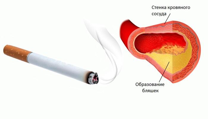 Через сколько восстановятся сосуды после отказа от курения?