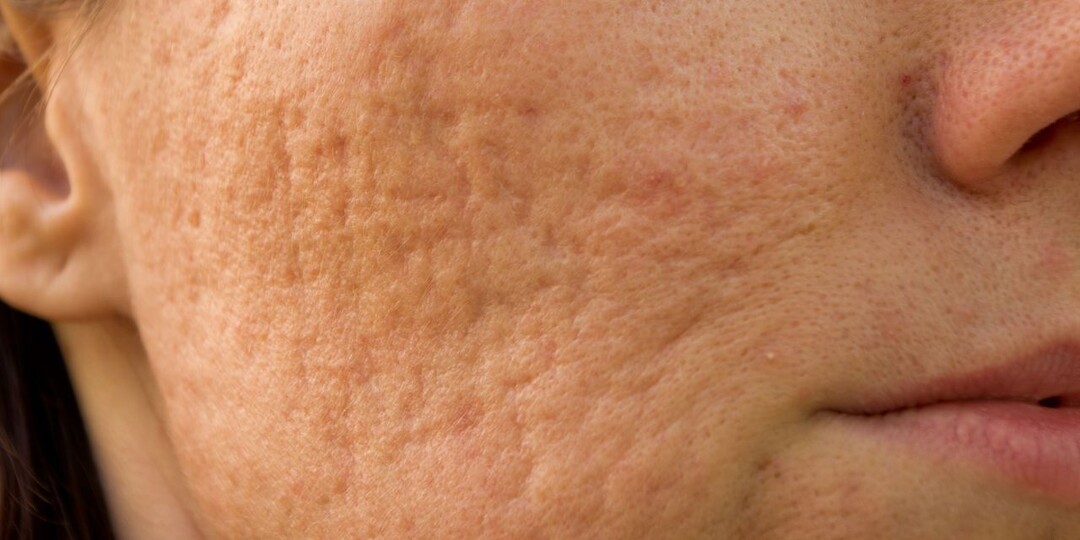 Кожа Стала Желтоватой — Что Проверяют Врачи В Первую Очередь