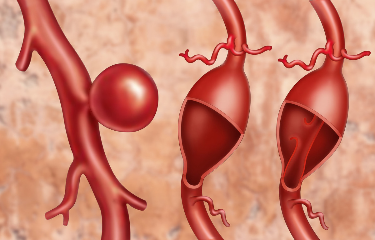 Чтобы не умереть в одно мгновенье: простой анализ, который спасет вашу жизнь