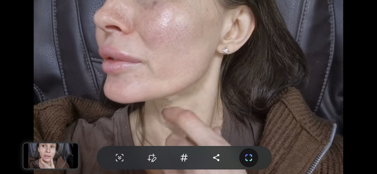 После аппарата Морфеус