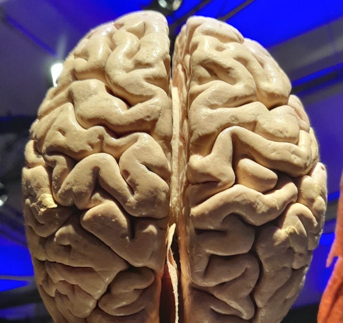 "Шевелисть извилинами" - не только метафора