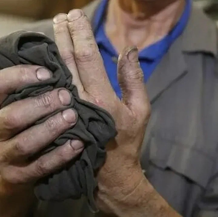 Такие же руки у моего знакомого. Руки рабочего человека!