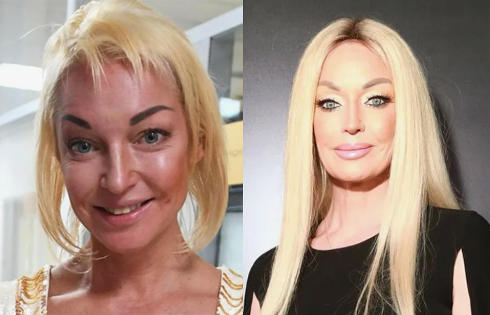 От природы волосы Волочковой очень тонкие.