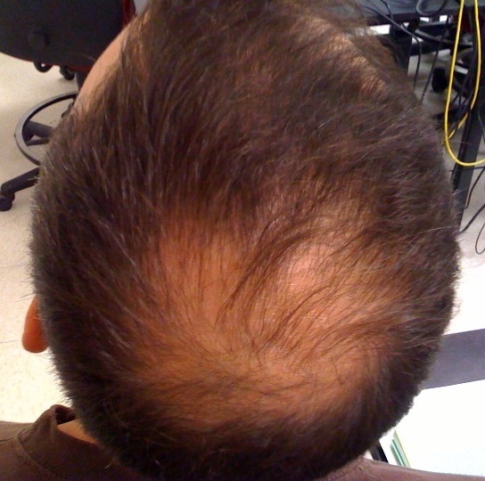 Древний китайский корень может помочь восстановить рост волос