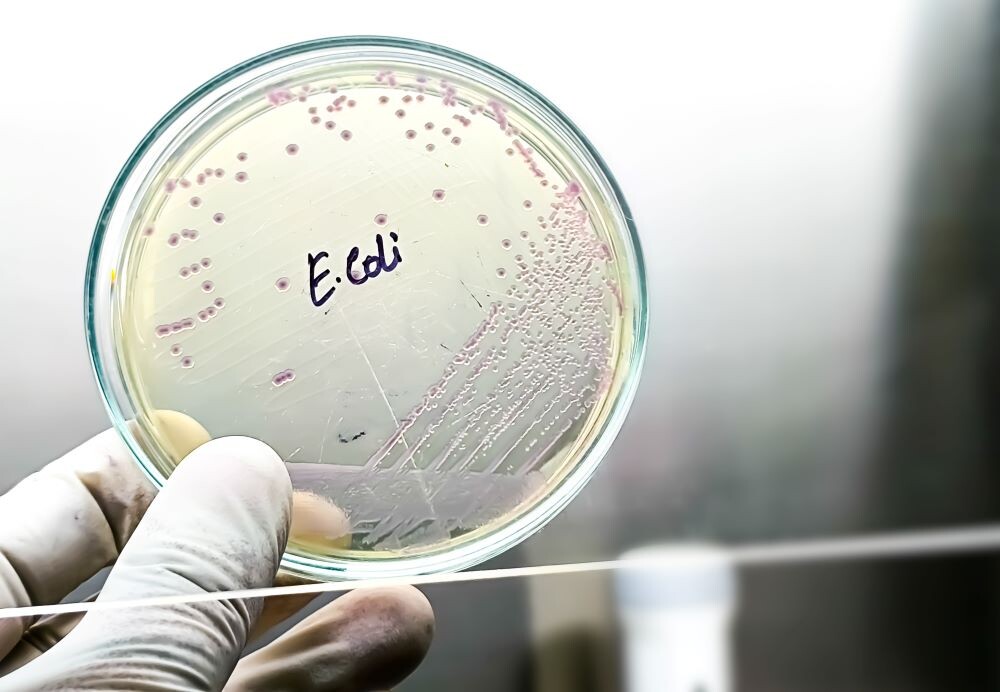 Кишечная палочка E.Coli