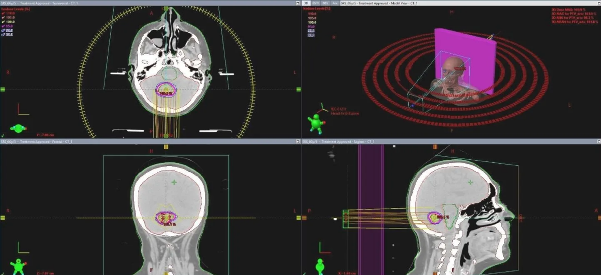 Фото: минздрав Псковской области