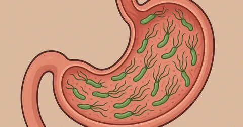 Хеликобактер пилори: тихий сосед вашего желудка, о котором вы должны знать