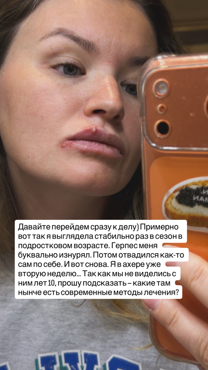 Это я вместо похода к вирусологу-иммунологу просила советов у подписчиков 😂