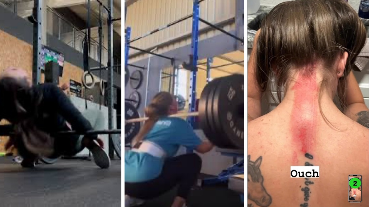 Речь о том, что волосы могут наматываться на оборудование. И особенно чревато это на приседаниях. Сколько этих видео в интернете… как штанга с волосами чуть ли не скал п снимает… наберите gym hair fail или squat hair injury. И хвост тоже не спасает! Еще недавно видела видео, как девушка с длинным хвостом делала выпад в кроссовере, наклонила голову, а волосы намотались на трос. Все произошло очень быстро