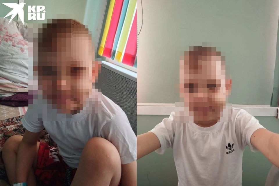 Отец быстро отвез ребенка в больницу, мальчику сделали операцию. Фото: Предоставлены родителями