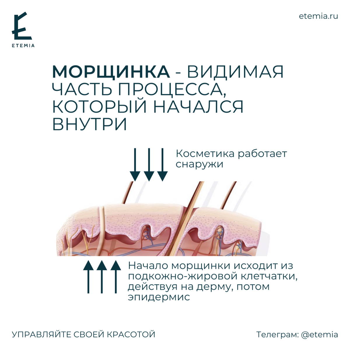 Морщинка - видимая часть процесса, который давно запущен внутри подкожно-жировой клетчатки, дермы и эпидермиса.