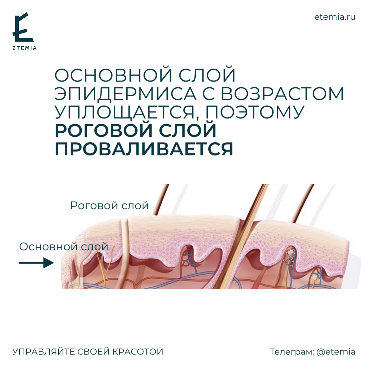 Основной слой эпидермиса с возрастом уплощается, поэтому видимый роговой слой "проваливается" и так образуя морщинку, залом.