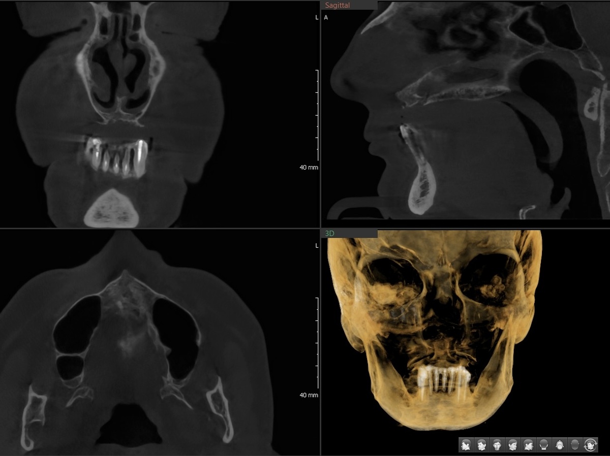 Смотрим прямо