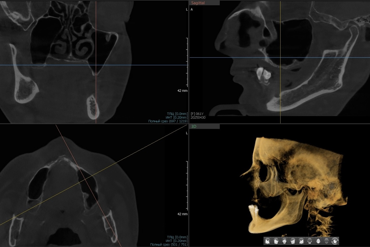 Левая сторона