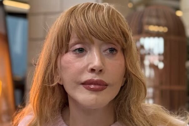     «Изменили лицо до неузнаваемости»: Алла Пугачева на новых фото мужа шокировала блогеров