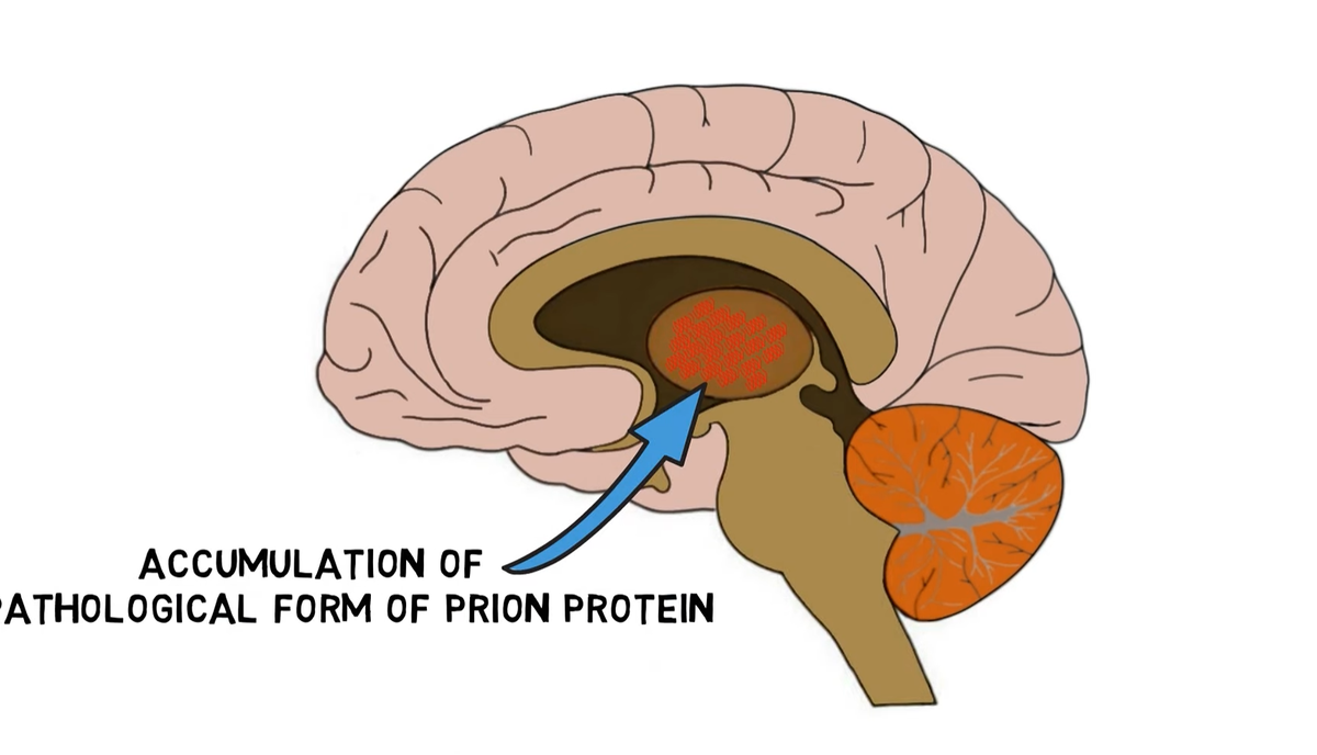 Особый белок, который и является всеми виной