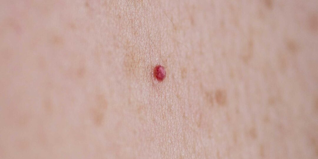 Красные точки на теле, которые появились внезапно