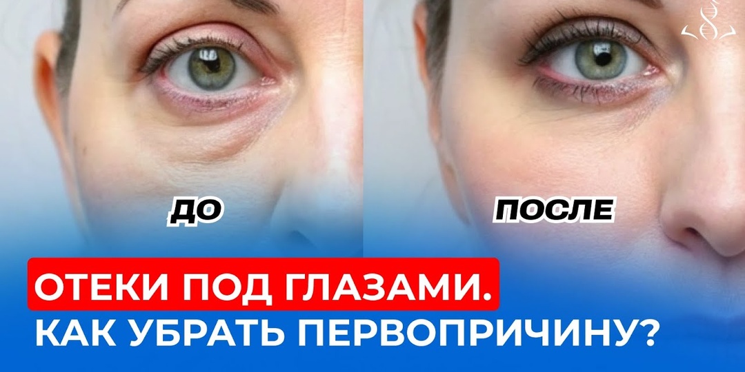 Отёчность лица по утрам — какие органы чаще всего проверяют