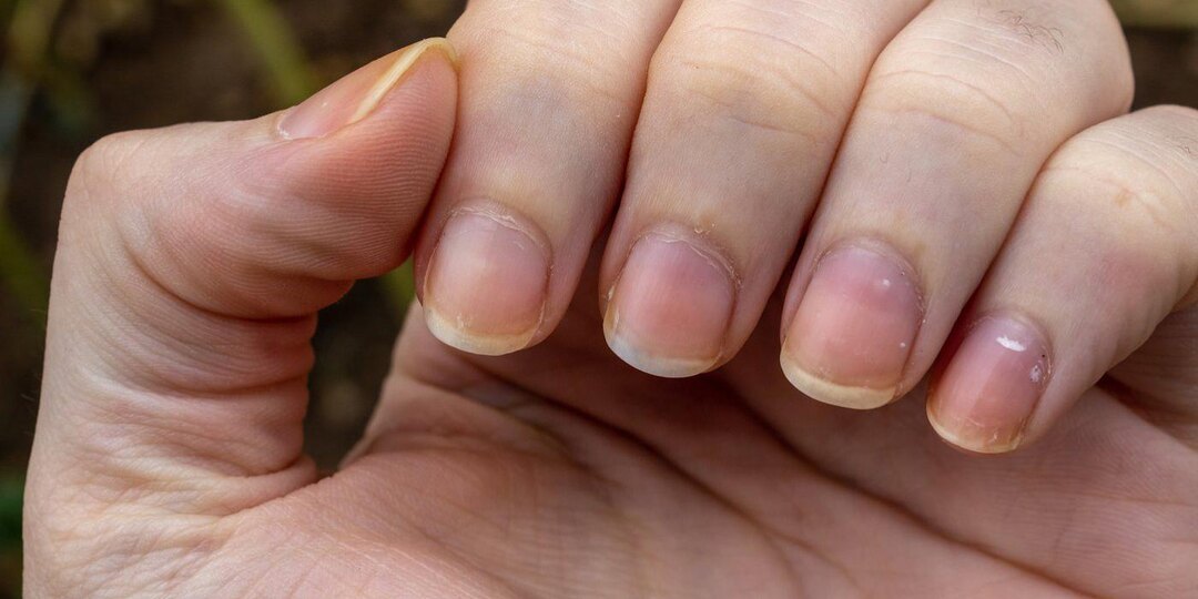Ногти стали синеватыми — почему это не игнорируют