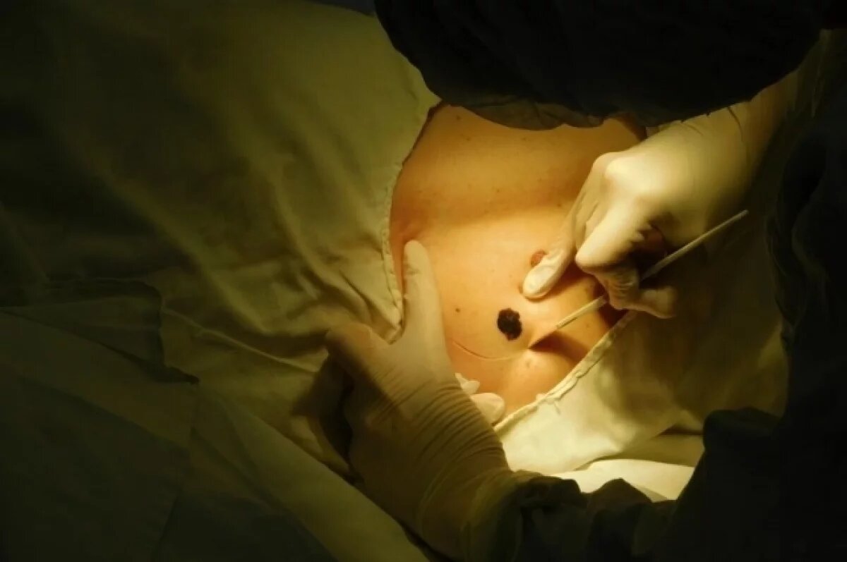    Одно из новообразований было на пояснице.