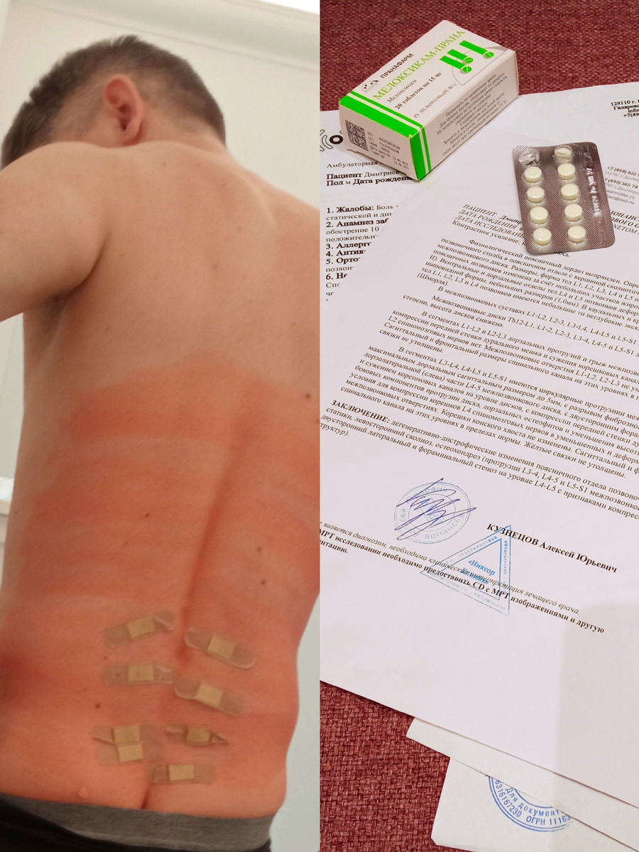 Боль в спине: мой путь