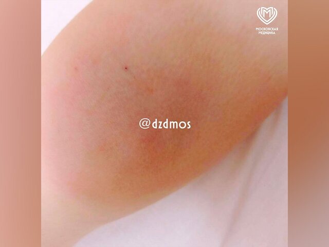    Фото: телеграм-канал "Московская медицина"
