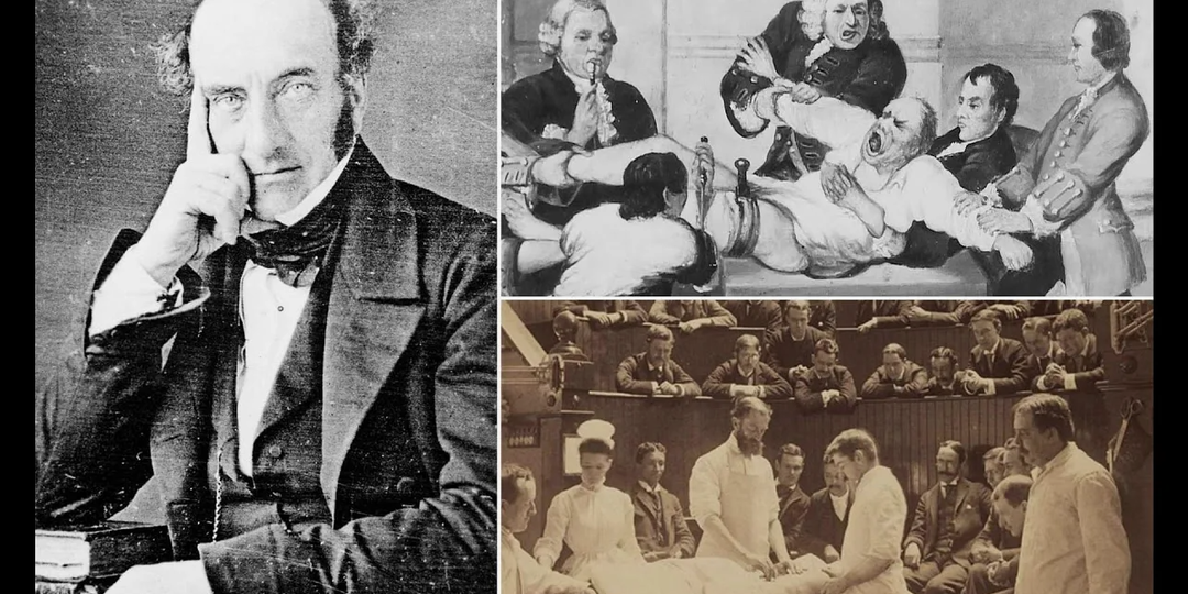 Операция XIX века: как Роберт Листон установил ужасающий рекорд