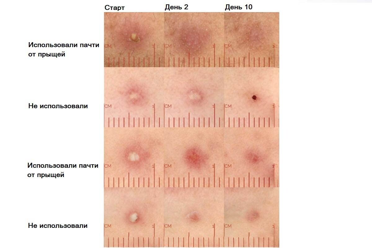 Результаты исследования. Источник: sciencedirect.com📷
