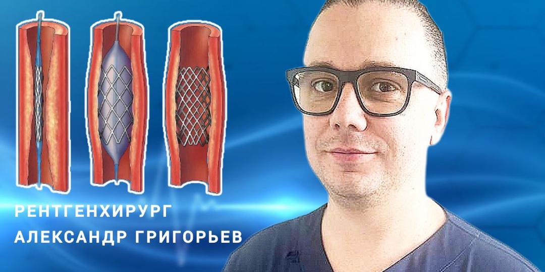 Как живут с большим количеством стентов