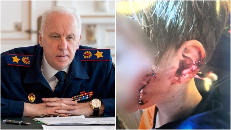 Растерзанный собакой мальчик. На публикацию "Взгляда" отреагировал глава СК РФ