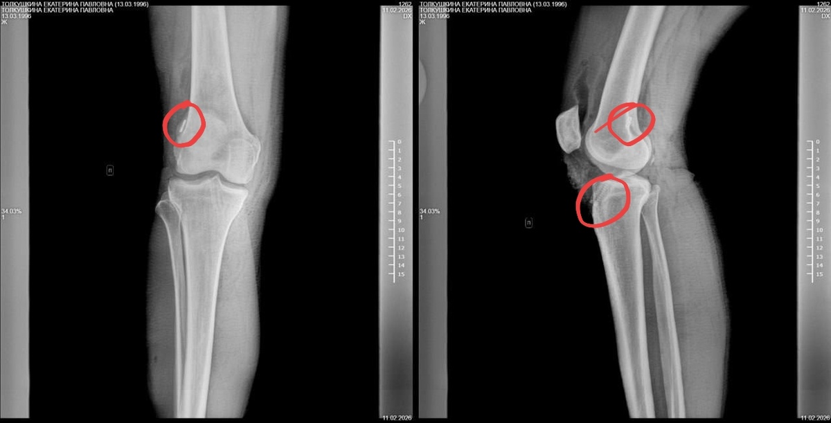 Винтик и пуговка