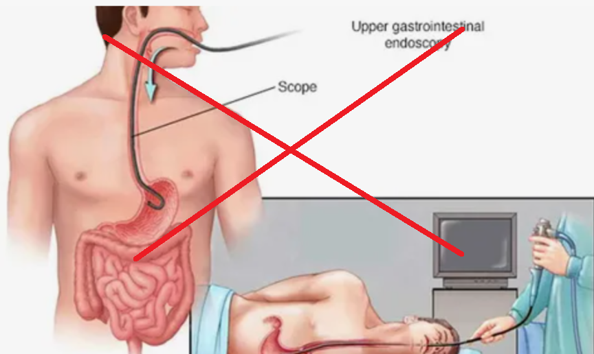 ФГДС: какой анализ заменяет "глотание трубки"?