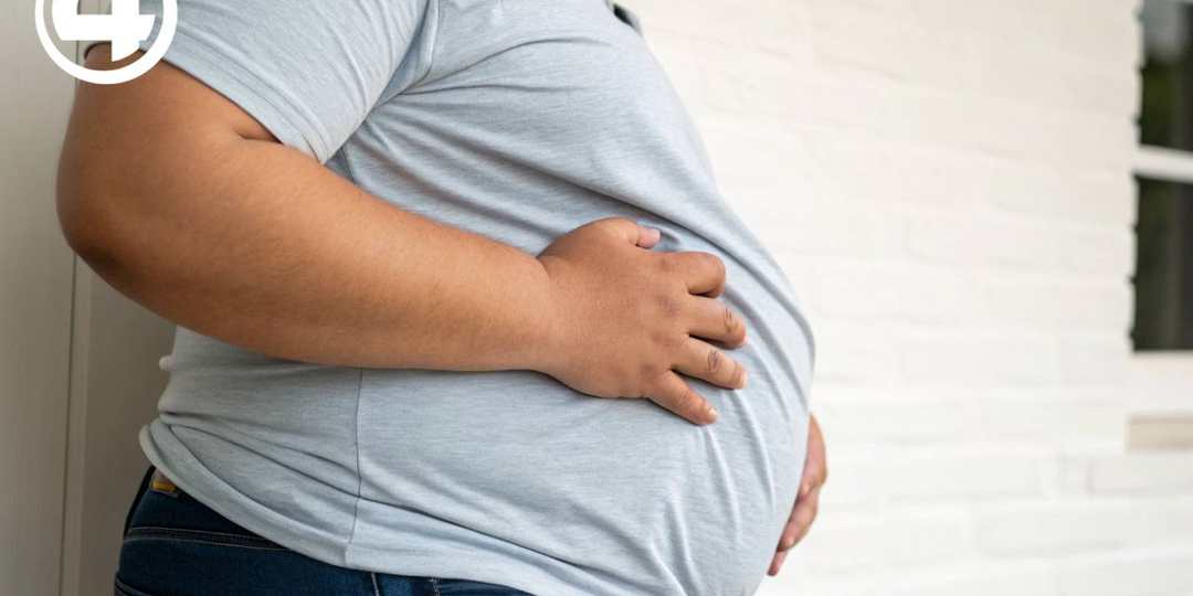 Бариатрический хирург: «Ожирение в России выросло на 52% за 5 лет»