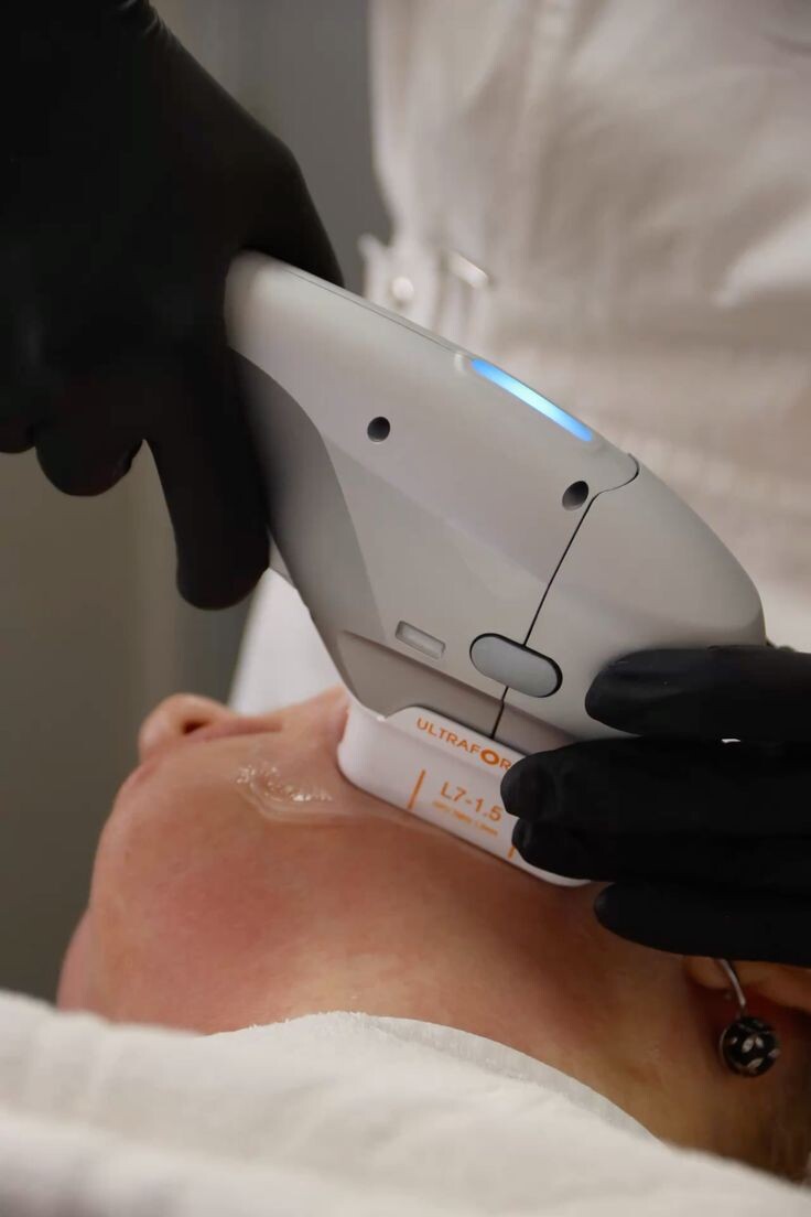 SMAS - лифтинг, ультразвуковая подтяжка