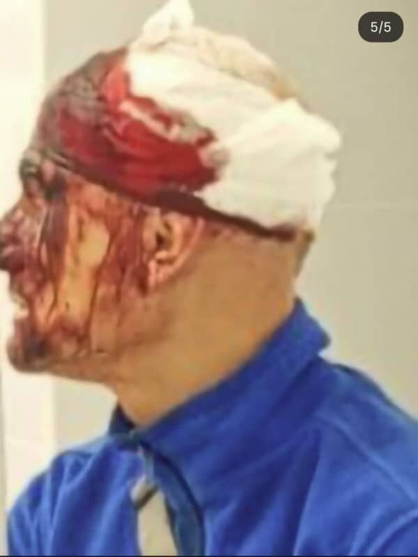    В Одессе мужчину мобилизовали с собакой, разбили голову пистолетом и истекающего кровью вывезли за город