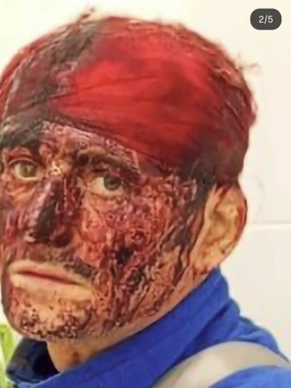    В Одессе мужчину мобилизовали с собакой, разбили голову пистолетом и истекающего кровью вывезли за город