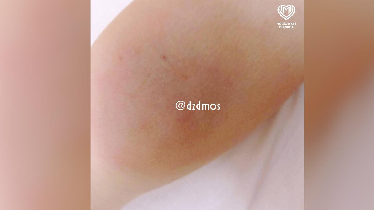    Фото: dzdmos / t.me