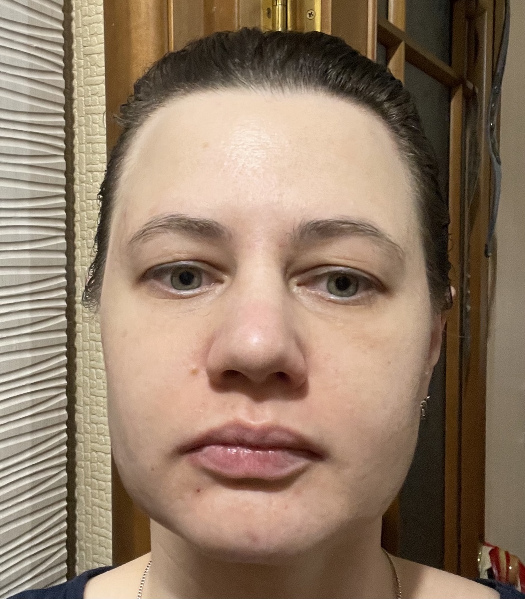 Фото до нанесения маски