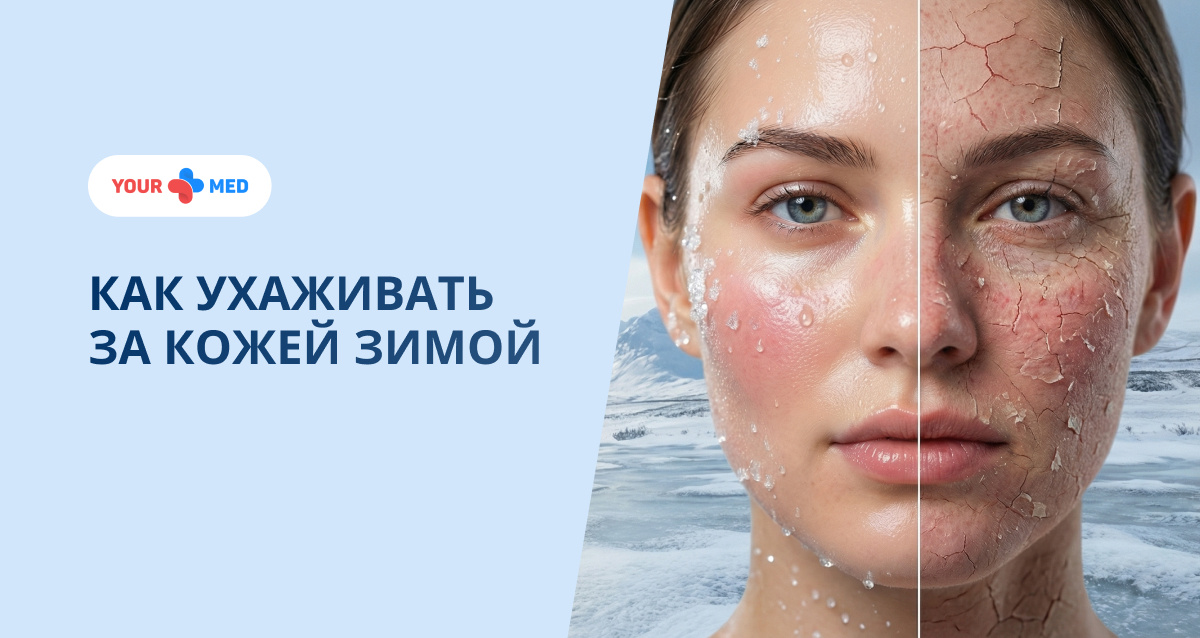 Зима — испытание для кожи. Рассказываем, как защитить её от сухости, шелушения и потери тонуса. Простые, но эффективные шаги к сияющей коже.

