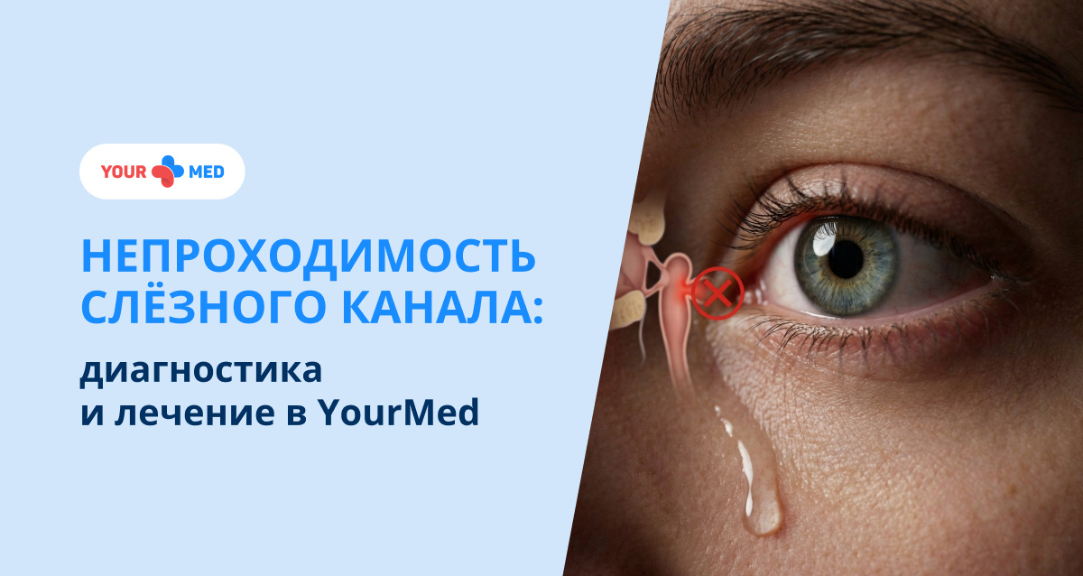 Глаза постоянно слезятся, но вы не понимаете почему? Рассказываем о причинах непроходимости слёзного канала, методах диагностики и современных способах лечения.
