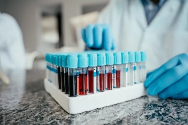    Чем опасен высокий гемоглобин?