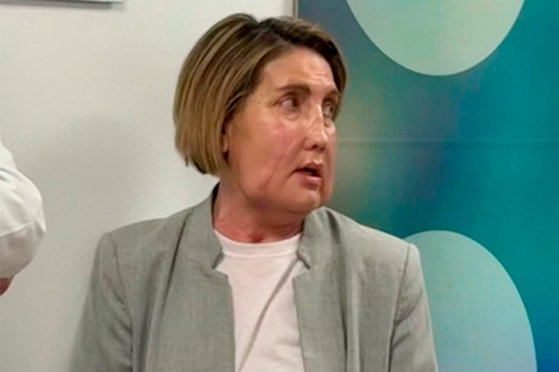    Фото: vallhebron.com