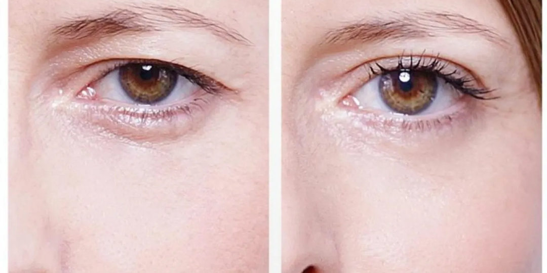 Нависшие веки подтягиваются, а глаза открываются: 5 способов, которые всегда мне помогают