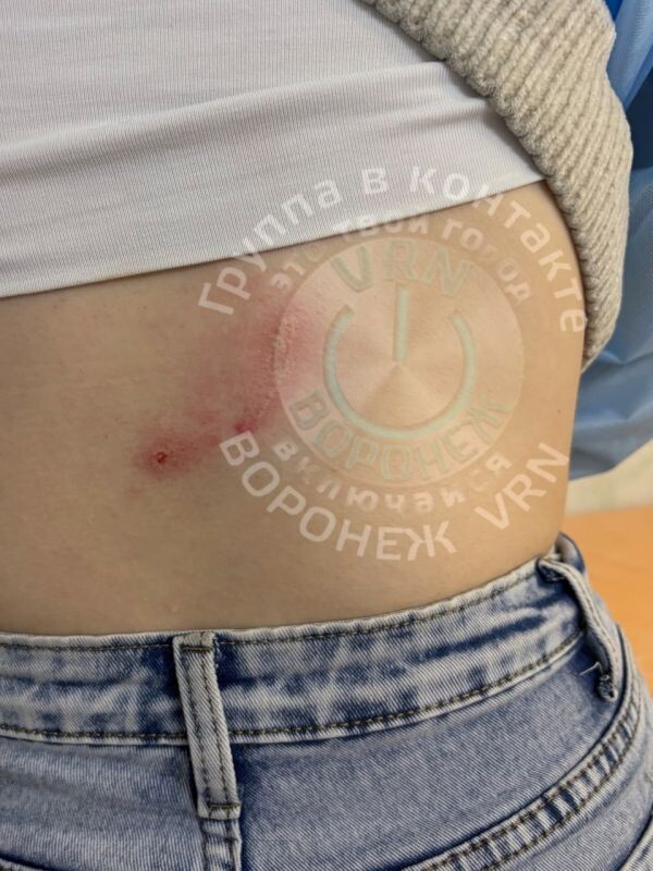    Фото: телеграм-канал "Воронеж VRN"